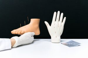 image-of-a-man-undergoing-acupuncture